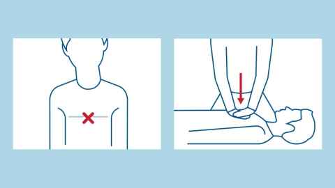 Emergency CPR 'pump' graphic demonstrating the first two steps of CPR.