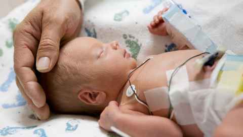 premature baby