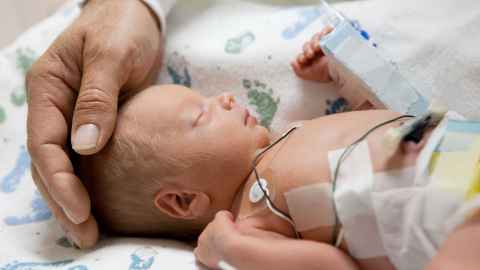 Premature baby
