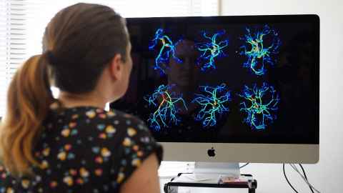 Associate Professor Alys Clark says a virtual placenta can reveal much that can't be seen in contemporary scanning technology.